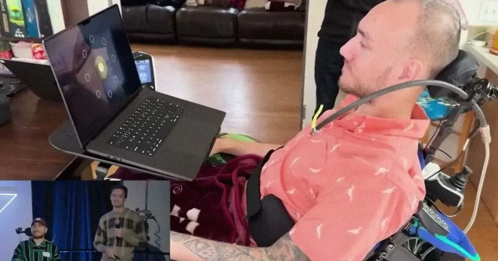Prvi pacijent Neuralinka koristi uređaj za učenje novih jezika 1