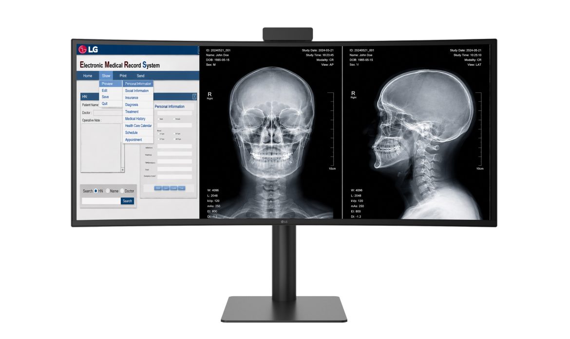zakrivljeni ultrawide dijagnostički monitor